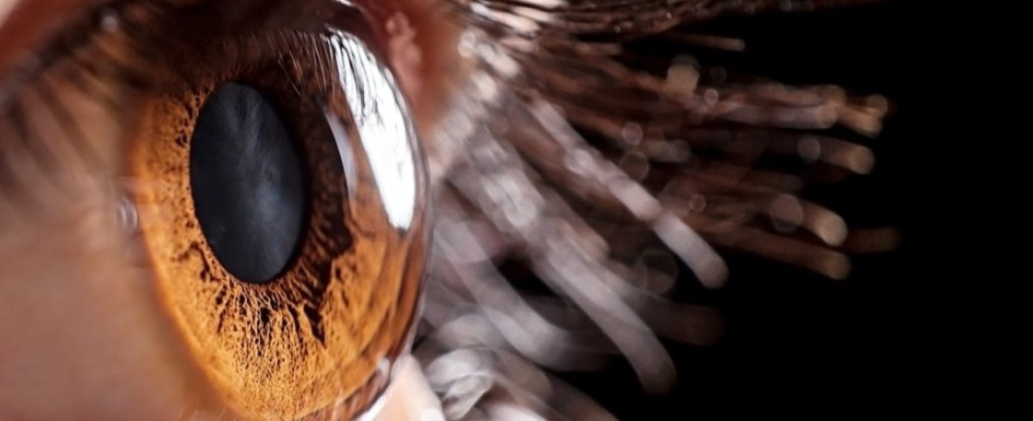 imagen de un ojo con retinitis pigmentosa.