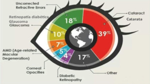 causas de la ceguera: imagen de una gráfica de sectores con los porcentajes de causas de la ceguera en el mundo