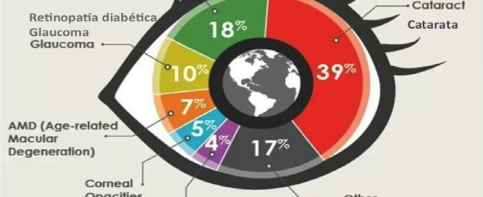 causas de la ceguera: imagen de una gráfica de sectores con los porcentajes de causas de la ceguera en el mundo