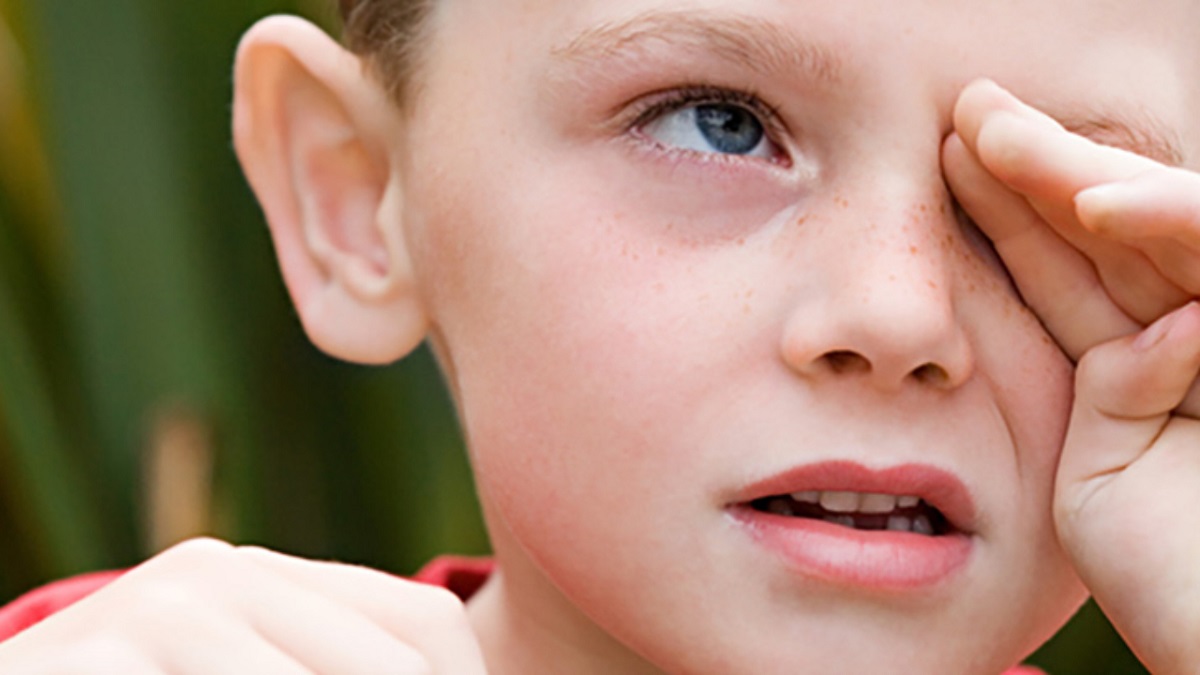 alergias oculares: imagen de un niño con alergia ocular