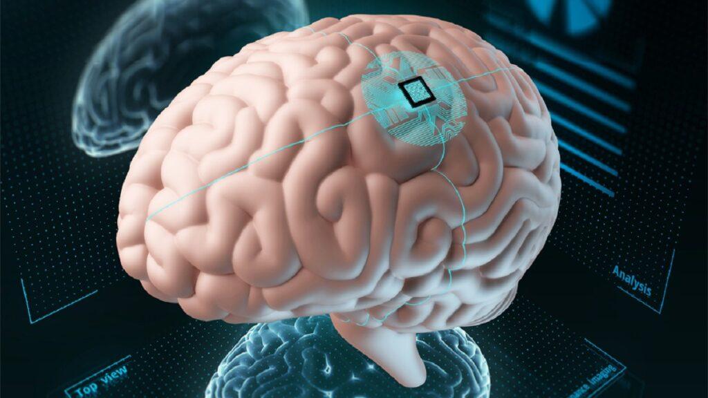 ejemplo de cómo pueden hacerse implantes cerebrales en humanos