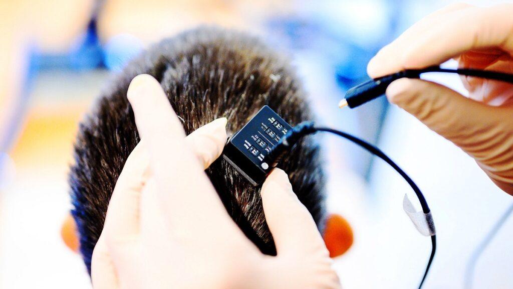 ejemplo de cómo pueden hacerse implantes cerebrales en humanos