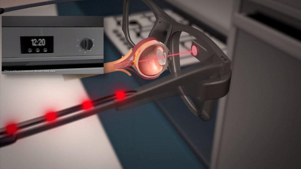 cómo funciona internamente el implante ocular prima